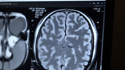 Medical MRI Analysis AI Demo
